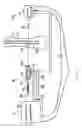 Fig. 02 - Intramedullary nail drill guide