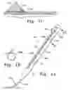 Fig. 02 - Surgical connection apparatus and methods