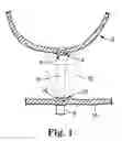 Fig. 02 - Anastomosis device and related methods