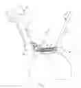 Fig. 02 - Reciprocating instrument for separating a cornea to form a corneal flap