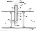 Fig. 01 - Percutaneous cellulite removal system