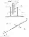 Fig. 02 - Percutaneous cellulite removal system