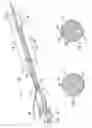 Fig. 02 - Stent delivery system and method of use