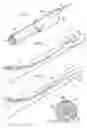 Fig. 07 - Stent delivery system and method of use