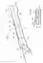Fig. 09 - Stent delivery system and method of use