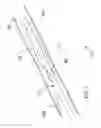 Fig. 02 - Catheter with protected occlusion balloon