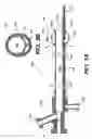 Fig. 07 - Emboli protection devices and related methods of use