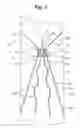 Fig. 02 - Recoilable thrombosis filtering device and method
