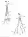 Fig. 06 - Recoilable thrombosis filtering device and method
