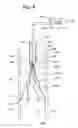 Fig. 07 - Recoilable thrombosis filtering device and method