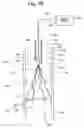 Fig. 09 - Recoilable thrombosis filtering device and method
