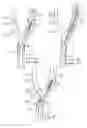 Fig. 02 - Apparatus and methods for reducing embolization during treatment of carotid artery disease