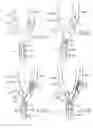 Fig. 04 - Apparatus and methods for reducing embolization during treatment of carotid artery disease