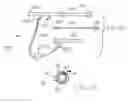 Fig. 05 - Apparatus and methods for reducing embolization during treatment of carotid artery disease
