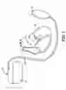 Fig. 02 - Apparatus for detecting and treating ventricular arrhythmia