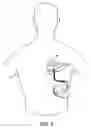 Fig. 07 - Apparatus for detecting and treating ventricular arrhythmia