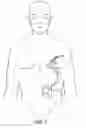 Fig. 08 - Apparatus for detecting and treating ventricular arrhythmia