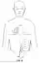 Fig. 09 - Apparatus for detecting and treating ventricular arrhythmia