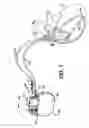 Fig. 02 - Connector header setscrew for an implantable medical device