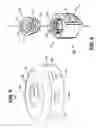 Fig. 07 - Connector header setscrew for an implantable medical device