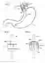 Fig. 06 - High frequency vagal blockage therapy