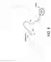 Fig. 09 - Method and system for providing electrical pulses to gastric wall of a patient with rechargeable implantable pulse generator for treating or controlling obesity and eating disorders