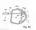 Fig. 22 - Device, a kit and a method for treatment of disorders in the heart rhythm regulation system