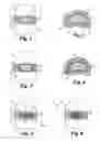 Fig. 02 - Instruments for delivery of intervertebral disc implants