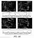 Fig. 52 - Method and arrangement for obtaining information about vehicle occupants