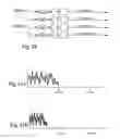 Fig. 06 - Time-scale modification of data-compressed audio information