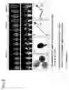 Fig. 06 - Solely pollen-specific promoter