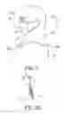 Fig. 03 - Facemask-inbuilt medical hood structure