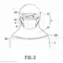 Fig. 04 - Facemask-inbuilt medical hood structure