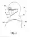 Fig. 05 - Facemask-inbuilt medical hood structure