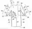 Fig. 01 - Surgical gown having an adhesive tab and methods of use