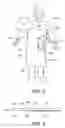 Fig. 04 - Surgical gown having an adhesive tab and methods of use