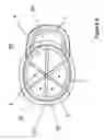 Fig. 07 - Elastic cap