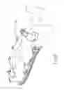 Fig. 09 - Paramedical transfer stretcher, harness and method