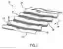 Fig. 02 - Activatable fastening system and web having elevated regions and functional material members