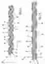 Fig. 09 - Activatable fastening system and web having elevated regions and functional material members