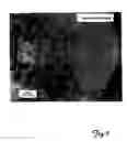 Fig. 06 - Aluminum oxide particles