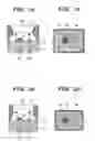 Fig. 02 - Package for mounting an optical element and a method of manufacturing the same