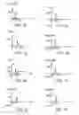 Fig. 06 - Method and apparatus for automotive rim edge analysis and corrective weight selection guide