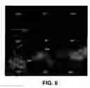Fig. 08 - Scanning acoustic microscopy