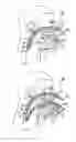 Fig. 02 - Device for the treatment of snoring and obstructive sleep apnea