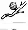 Fig. 07 - Compositions and methods for improved occlusion of vascular defects