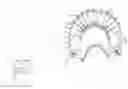 Fig. 01 - Multi-sulcus flossing device