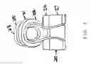 Fig. 04 - Multi-sulcus flossing device