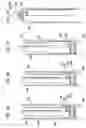 Fig. 04 - Apparatus for and method of anchoring a first conduit to a second conduit