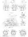 Fig. 06 - Roller cone drill bits with enhanced cutting elements and cutting structures